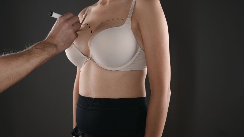 Don’t miss out on the Breast Augmentation Miami you need