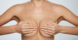 Get the Celebrity Look: Breast Implants in Miami